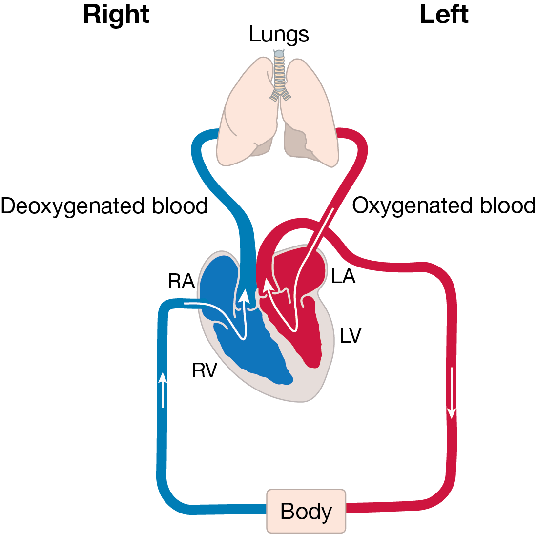 Double Outlet Right Ventricle (DORV) - Little Hearts Matter