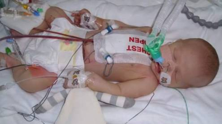 My baby was only three days old when he had an open heart operation.
